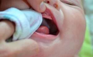 Read more about the article Oralna higijena beba prije nicanja prvih mliječnih zuba i nakon
